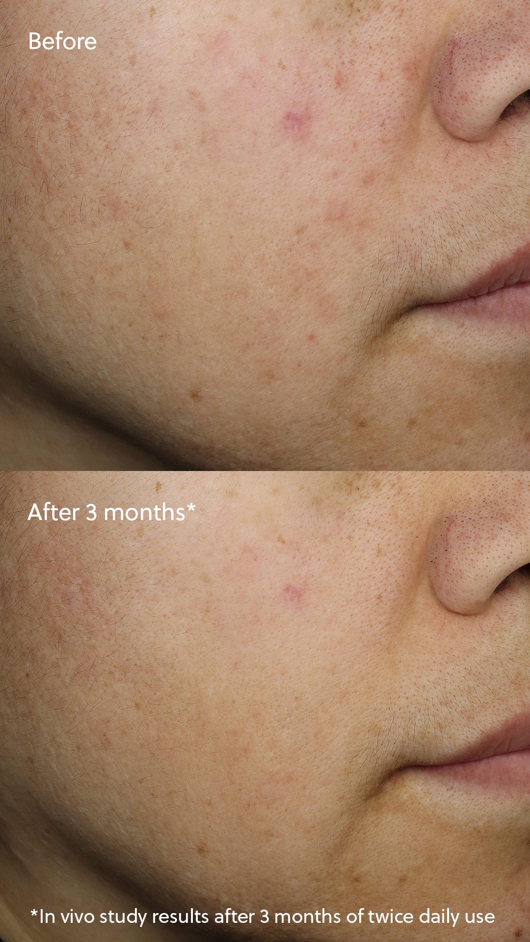 Eminence | Vitamin C⁺ Serum