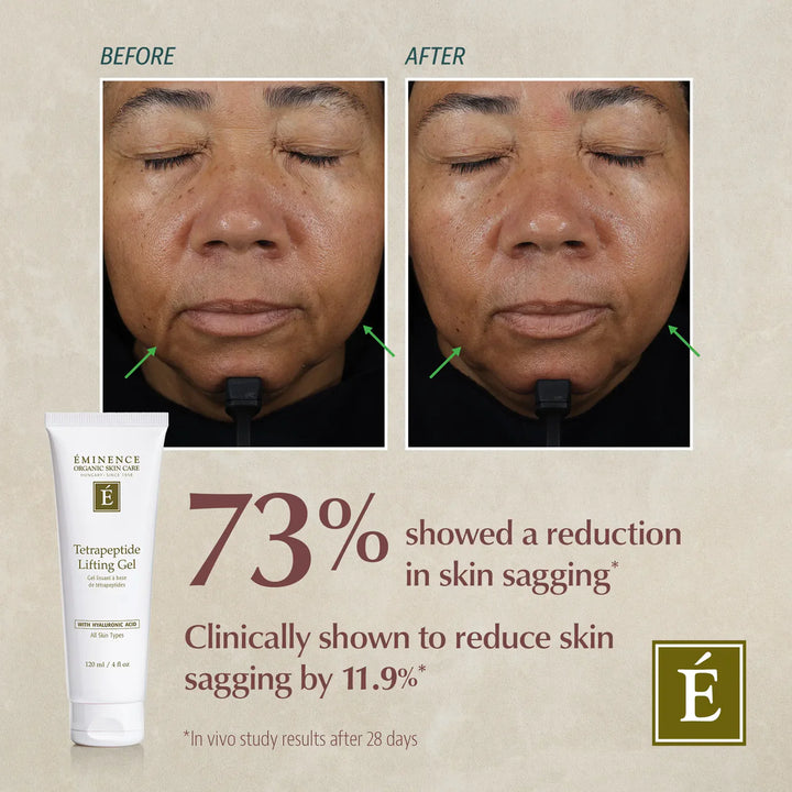 Eminence | Tetrapeptide Lifting Gel